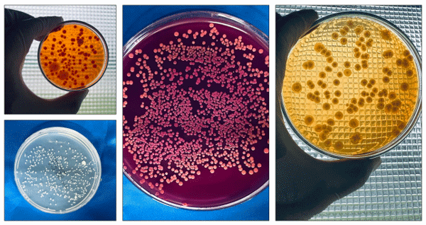 Figure 1. Bacterial colonies grown on different culture media from samples collected from eggshells (immediately after collection)