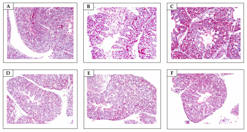 Figure 7. Lungs. (A) Non-sanitized eggs (NE). Unremarkable microscopic changes (H&E, objective 20×). (B) Grain alcohol (GA). Unremarkable microscopic changes (H&E, objective 20×). (C) Formaldehyde (FA). Severe pulmonary congestion (H&E, objective 20×). (D) Citrus aurantifolia essential oil (CAEO). (E) Ocimum basilicum essential oil (OBEO). (F) Allium sativum essential oil (ASEO). Unremarkable microscopic changes (H&E, objective 20×).