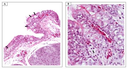 Figure 6. Tracheae. (A) Formaldehyde (FA) group. Multifocal goblet cell hyperplasia (arrows) (H&E, objective 40×). (B) FA group. Mononuclear inflammatory infiltration (arrows) (H&E, objective 40×).