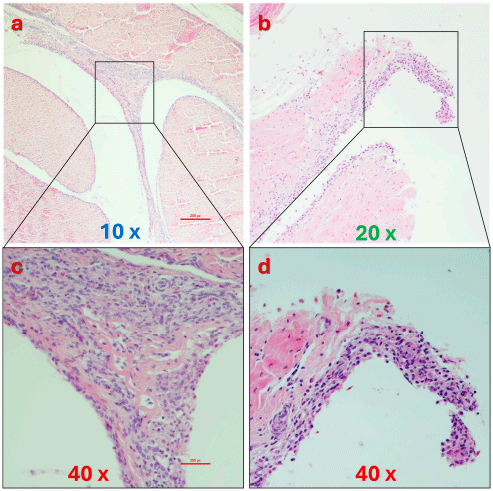 Figure 11. Histopathology in tendons of ARV-infected broilers. Tendon tissues showed mild to moderate multifocal thickening of the synovium with mononuclear inflammatory cell infiltrates and synovial hyperplasia (a,b). (c,d) are higher magnifications of the boxed areas in (a,b), respectively