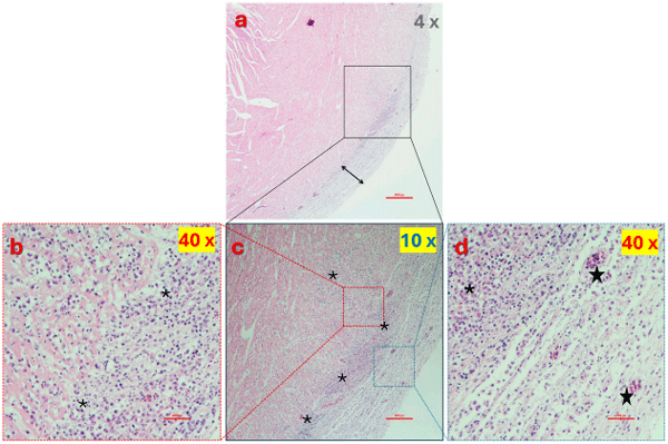 Figure 12. Histopathology of the heart of ARV-infected broilers. Heart tissue demonstrated moderate diffuse thickening of the pericardium ((a), pericardium delineated by a double-headed arrow) characterized by accumulations of fibrin, edema, vascular congestion (starred), and lymphoplasmacytic infiltration (asterisks) with multifocal extension into the myocardium (b) and epicardium (d). (c) is a higher magnification of the squared area of subfigure (a).