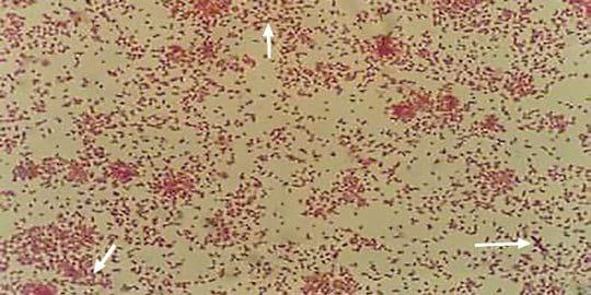Fowl Cholera in poultry - Image 1