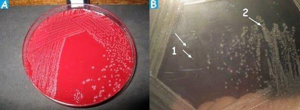 Fowl Cholera in poultry - Image 7