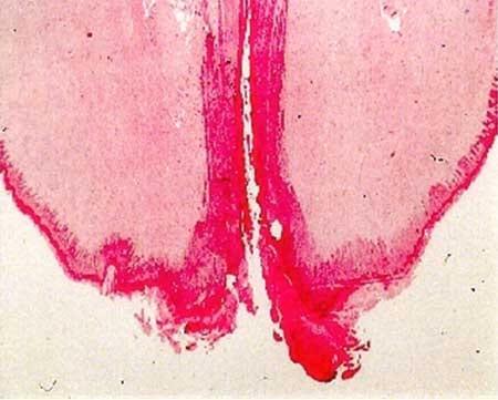 Dairy Cattle: Teat End Condition Matters - Image 1