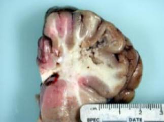 Fumonisins - Mycotoxins of increasing importance! - Image 5