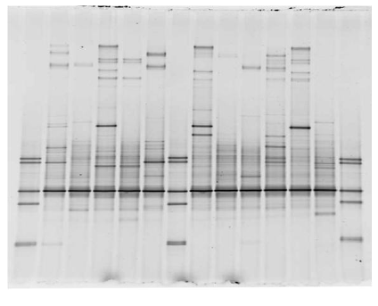 Exploring the intestinal microflora with DGGE - Image 2