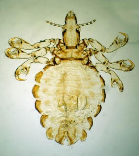 External Parasites on Swine - Image 1