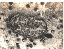 Mycoplasma Complicated Chronic Respiratory Disease (CCRD) -A Review - Image 6