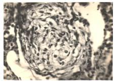 Mycoplasma Complicated Chronic Respiratory Disease (CCRD) -A Review - Image 9