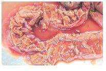 Managing Sub Clinical Necrotic Enteritis – Made Easy - Image 12