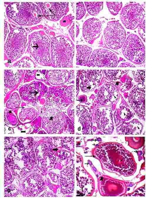 Morphology of ovary and testis of Nile tilapia exposed to control