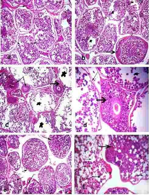 Morphology of ovary and testis of Nile tilapia exposed to control