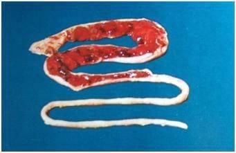 Coccidiosis in Poultry- A Review - Image 10