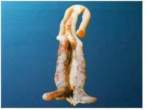 Coccidiosis in Poultry- A Review - Image 5