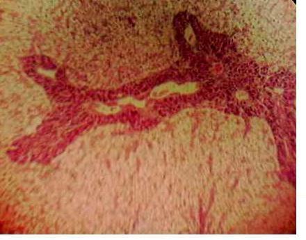 Effect of Source and Level of Dietary Water Hyacinth on Nile Tilapia Oreochromis Niloticus- Histopathology - Image 5