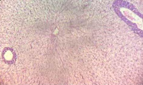 Effect of Source and Level of Dietary Water Hyacinth on Nile Tilapia Oreochromis Niloticus- Histopathology - Image 8