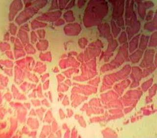 Effect of Source and Level of Dietary Water Hyacinth on Nile Tilapia Oreochromis Niloticus- Histopathology - Image 30