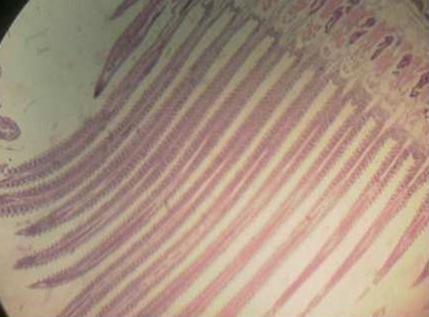 Effect of Source and Level of Dietary Water Hyacinth on Nile Tilapia Oreochromis Niloticus- Histopathology - Image 25