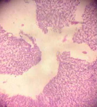 Effect of Source and Level of Dietary Water Hyacinth on Nile Tilapia Oreochromis Niloticus- Histopathology - Image 11