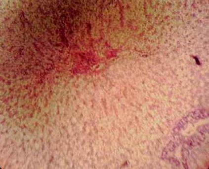 Effect of Source and Level of Dietary Water Hyacinth on Nile Tilapia Oreochromis Niloticus- Histopathology - Image 3