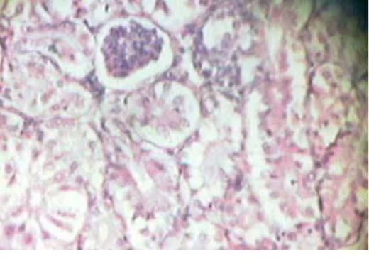 Effect of Source and Level of Dietary Water Hyacinth on Nile Tilapia Oreochromis Niloticus- Histopathology - Image 18