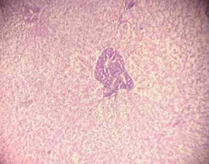 Effect of Source and Level of Dietary Water Hyacinth on Nile Tilapia Oreochromis Niloticus- Histopathology - Image 9