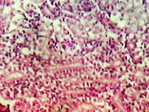 Effect of Source and Level of Dietary Water Hyacinth on Nile Tilapia Oreochromis Niloticus- Histopathology - Image 19