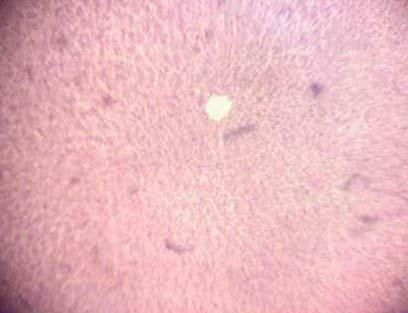 Effect of Source and Level of Dietary Water Hyacinth on Nile Tilapia Oreochromis Niloticus- Histopathology - Image 1