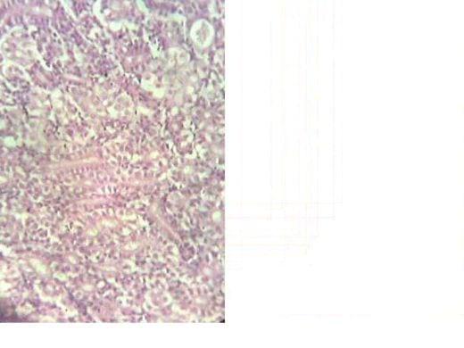 Effect of Source and Level of Dietary Water Hyacinth on Nile Tilapia Oreochromis Niloticus- Histopathology - Image 22