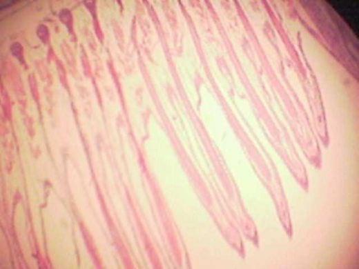 Effect of Source and Level of Dietary Water Hyacinth on Nile Tilapia Oreochromis Niloticus- Histopathology - Image 28
