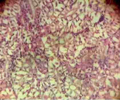 Effect of Source and Level of Dietary Water Hyacinth on Nile Tilapia Oreochromis Niloticus- Histopathology - Image 21
