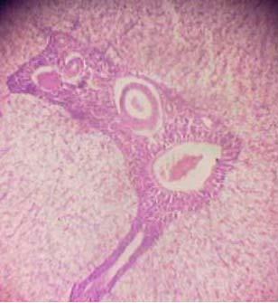 Effect of Source and Level of Dietary Water Hyacinth on Nile Tilapia Oreochromis Niloticus- Histopathology - Image 10