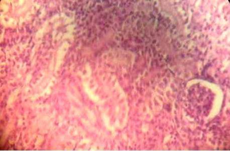 Effect of Source and Level of Dietary Water Hyacinth on Nile Tilapia Oreochromis Niloticus- Histopathology - Image 17