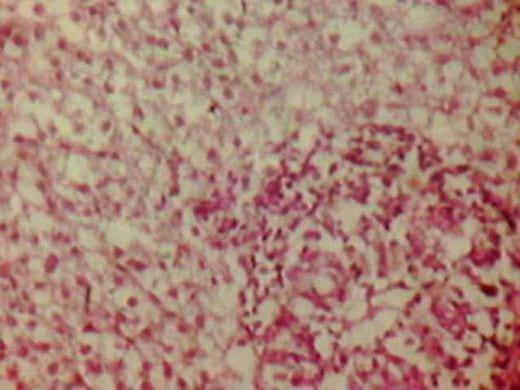 Effect of Source and Level of Dietary Water Hyacinth on Nile Tilapia Oreochromis Niloticus- Histopathology - Image 7