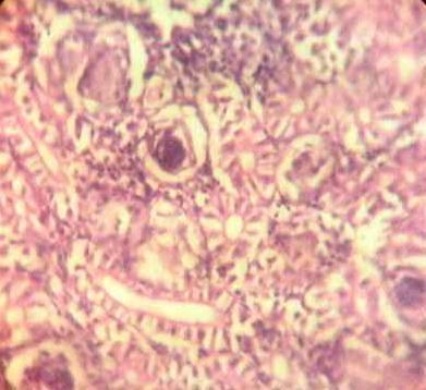 Effect of Source and Level of Dietary Water Hyacinth on Nile Tilapia Oreochromis Niloticus- Histopathology - Image 16