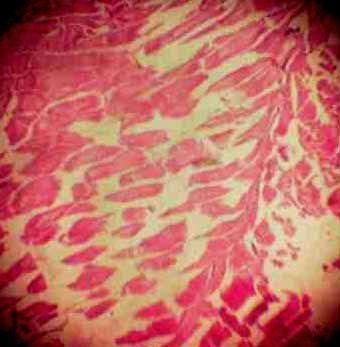 Effect of Source and Level of Dietary Water Hyacinth on Nile Tilapia Oreochromis Niloticus- Histopathology - Image 33