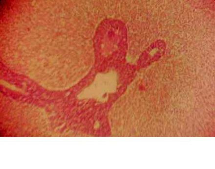 Effect of Source and Level of Dietary Water Hyacinth on Nile Tilapia Oreochromis Niloticus- Histopathology - Image 4
