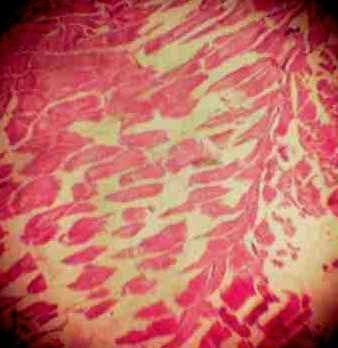Effect of Source and Level of Dietary Water Hyacinth on Nile Tilapia Oreochromis Niloticus- Histopathology - Image 32