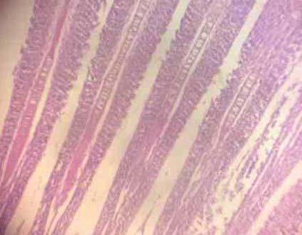 Effect of Source and Level of Dietary Water Hyacinth on Nile Tilapia Oreochromis Niloticus- Histopathology - Image 26