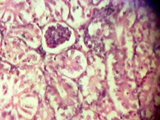 Effect of Source and Level of Dietary Water Hyacinth on Nile Tilapia Oreochromis Niloticus- Histopathology - Image 13