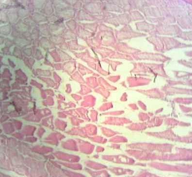Effect of Source and Level of Dietary Water Hyacinth on Nile Tilapia Oreochromis Niloticus- Histopathology - Image 29