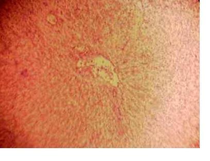 Effect of Source and Level of Dietary Water Hyacinth on Nile Tilapia Oreochromis Niloticus- Histopathology - Image 2