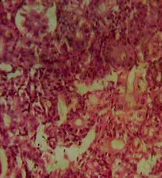 Effect of Source and Level of Dietary Water Hyacinth on Nile Tilapia Oreochromis Niloticus- Histopathology - Image 23