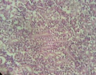 Effect of Source and Level of Dietary Water Hyacinth on Nile Tilapia Oreochromis Niloticus- Histopathology - Image 15