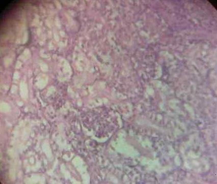 Effect of Source and Level of Dietary Water Hyacinth on Nile Tilapia Oreochromis Niloticus- Histopathology - Image 14