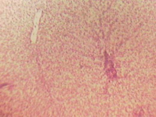 Effect of Source and Level of Dietary Water Hyacinth on Nile Tilapia Oreochromis Niloticus- Histopathology - Image 6