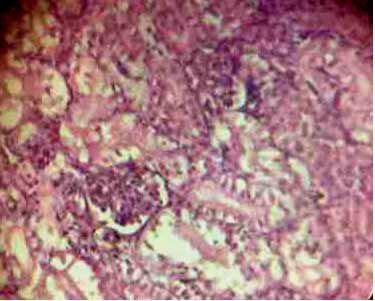 Effect of Source and Level of Dietary Water Hyacinth on Nile Tilapia Oreochromis Niloticus- Histopathology - Image 20
