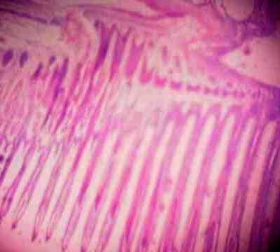 Effect of Source and Level of Dietary Water Hyacinth on Nile Tilapia Oreochromis Niloticus- Histopathology - Image 27