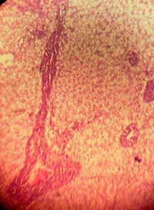 Effect of Source and Level of Dietary Water Hyacinth on Nile Tilapia Oreochromis Niloticus- Histopathology - Image 12