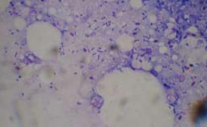 Important Diseases of Farmed Barramundi in Asia - Image 6